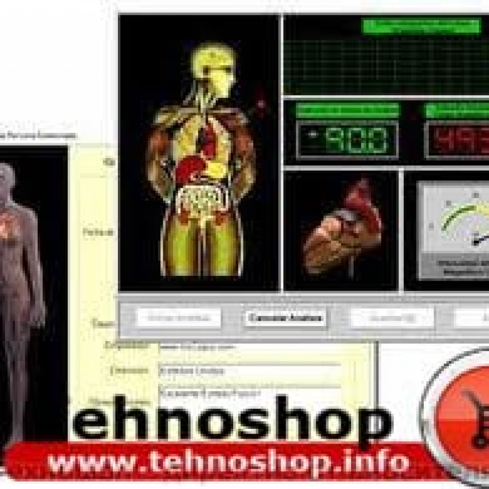 КВАНТОВ АНАЛИЗАТОР /БИОСКЕНЕР/ - АПАРАТ ЗА КОМПЮТЪРНА ДИАГНОСТИКА НА ЗДАВОСЛОВНОТО СЪСТОЯНИЕ