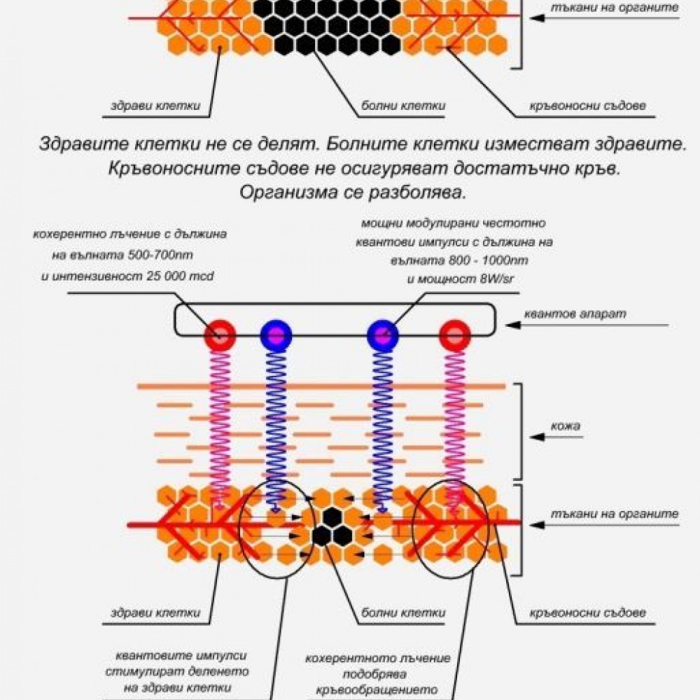 ИНТРОСКАН - РУСКИ АПАРАТ ЗА КОМПЛЕКСНА КВАНТОВА ФИЗИОТЕРАПИЯ С ЛАЗЕРНО, ИНФРАЧЕРВЕНО, UV-УЛТРАВИОЛЕТОВО И ЕЛЕКТРОМАГНИТНО ИЗЛЪЧВАНЕ, ЛЪЧНИЕ ВЪВ ВИДИМИЯ ДИАПАЗОН, КАКТО И КОМБИНАЦИИ ОТ ВСИЧКИ ТЯХ.