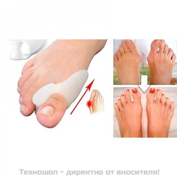 Силиконов разделител за пръсти – снимка 5
