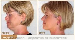 УРЕД ПРОТИВ ДВОЙНА БРАДИЧКА "Neckline Slimmer" – снимка 12