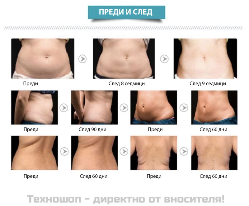 Апарат за кавитация, вакуум и радиочестотен лифтинг 5в1 – снимка 7