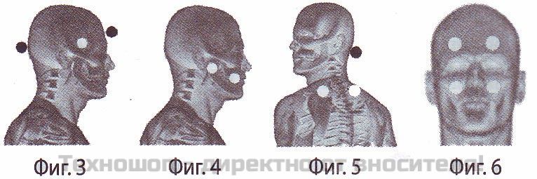 НЕОГАРД ЛАЙФ - МАГНИТЕН УРЕД ЗА ЗАЩИТА И ТЕРАПИЯ – снимка 4