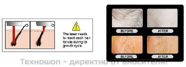 ЛАЗЕРЕН ЕПИЛАТОР "XEMOS LAZER W-808" - ЕПИЛАТОР ОТ НОВО ПОКОЛЕНИЕ. С МОЩЕН ДИОДЕН ЛАЗЕР ! ДЪЛЖИНА НА ВЪЛНАТА- 808 nm - СЪЩАТА КАТО ПРИ ПРОФЕСИОНАЛНИТЕ ЛАЗЕРНИ ЕПИЛАТОРИ – снимка 15