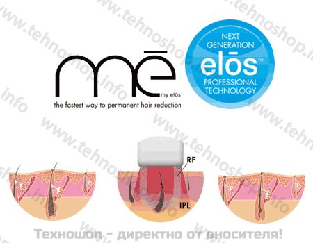 ФОТОЕПИЛАТОР "ME MY ELOS TOUCH" - 150 000 ДОЖИВОТНИ ИМПУЛСА – снимка 2