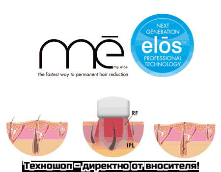 ФОТОЕПИЛАТОР "ME MY ELOS TOUCH" - 300 000 ДОЖИВОТНИ ИМПУЛСА + ПОДАРЪК: Приставка за прецизно третиране – снимка 2