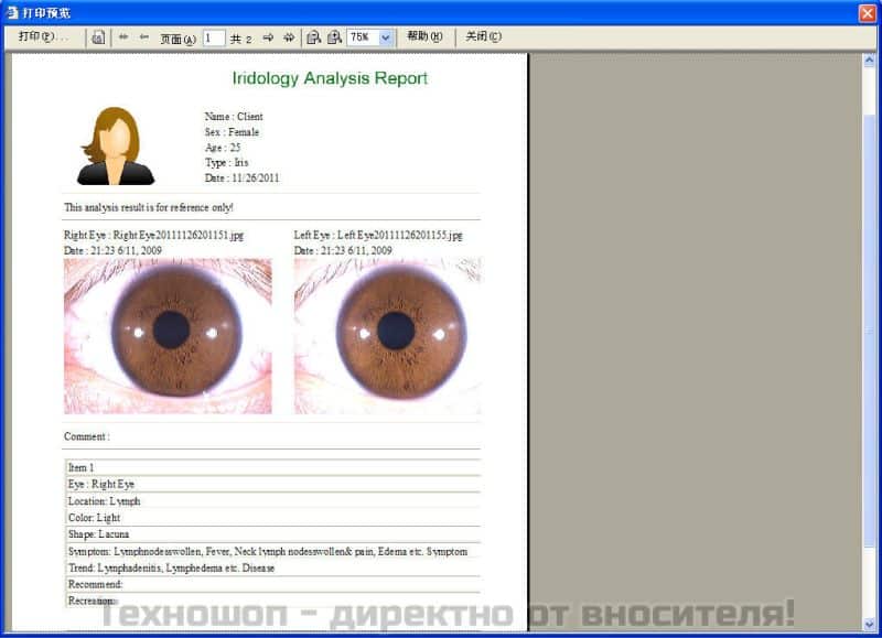 ИРИСОВА ДИАГНОСТИКА - УРЕД ЗА ИРИСОВА ДИАГНОСТИКА – снимка 3