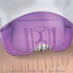 Прецизен дамски епилатор Epi Smooth