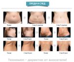Апарат за кавитация