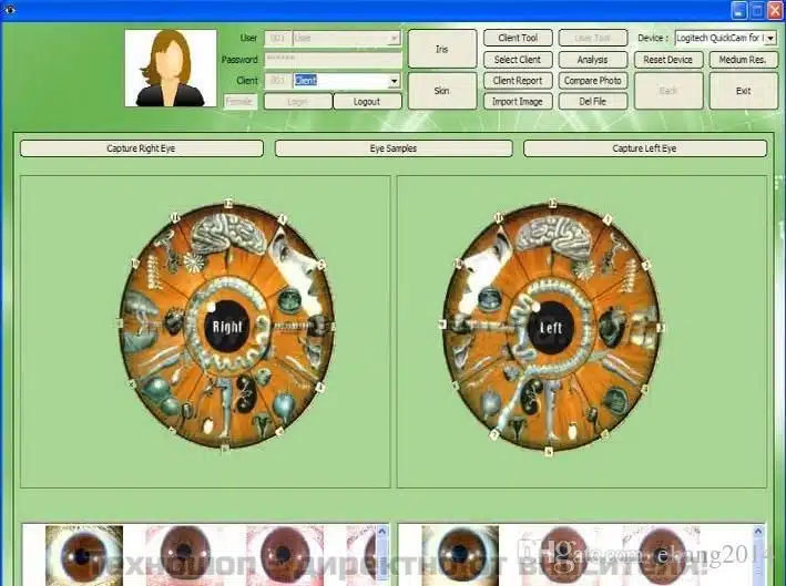 ИРИСОВА ДИАГНОСТИКА - УРЕД ЗА ИРИСОВА ДИАГНОСТИКА ИРИСОВА ДИАГНОСТИКА - УРЕД ЗА ИРИСОВА ДИАГНОСТИКА