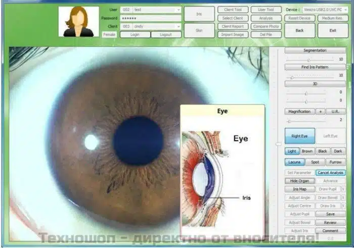 ИРИСОВА ДИАГНОСТИКА - УРЕД ЗА ИРИСОВА ДИАГНОСТИКА ИРИСОВА ДИАГНОСТИКА - УРЕД ЗА ИРИСОВА ДИАГНОСТИКА
