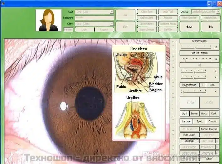 ИРИСОВА ДИАГНОСТИКА - УРЕД ЗА ИРИСОВА ДИАГНОСТИКА ИРИСОВА ДИАГНОСТИКА - УРЕД ЗА ИРИСОВА ДИАГНОСТИКА