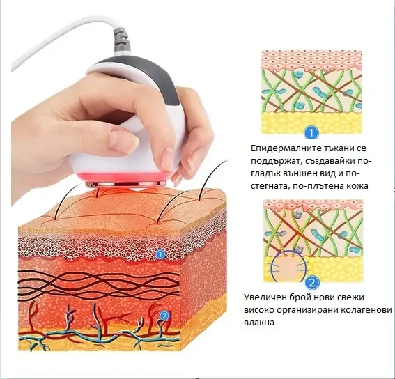 Ултразвукова кавитация - 60Khz за премахване/изгаряне на мазнини и целулит